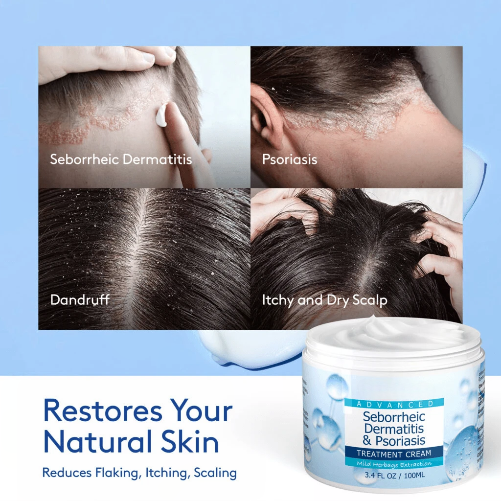 Seborrheic Dermatitis & Psoriasis Cream – Calming Moisturizer for Itch & Flake Relief (50ml) - ElevateHealthTech