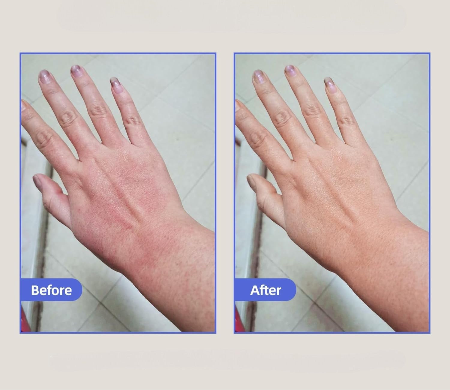 Healed My Eczema – Soothing Cream for Calming & Restoring Irritated Skin - ElevateHealthTech