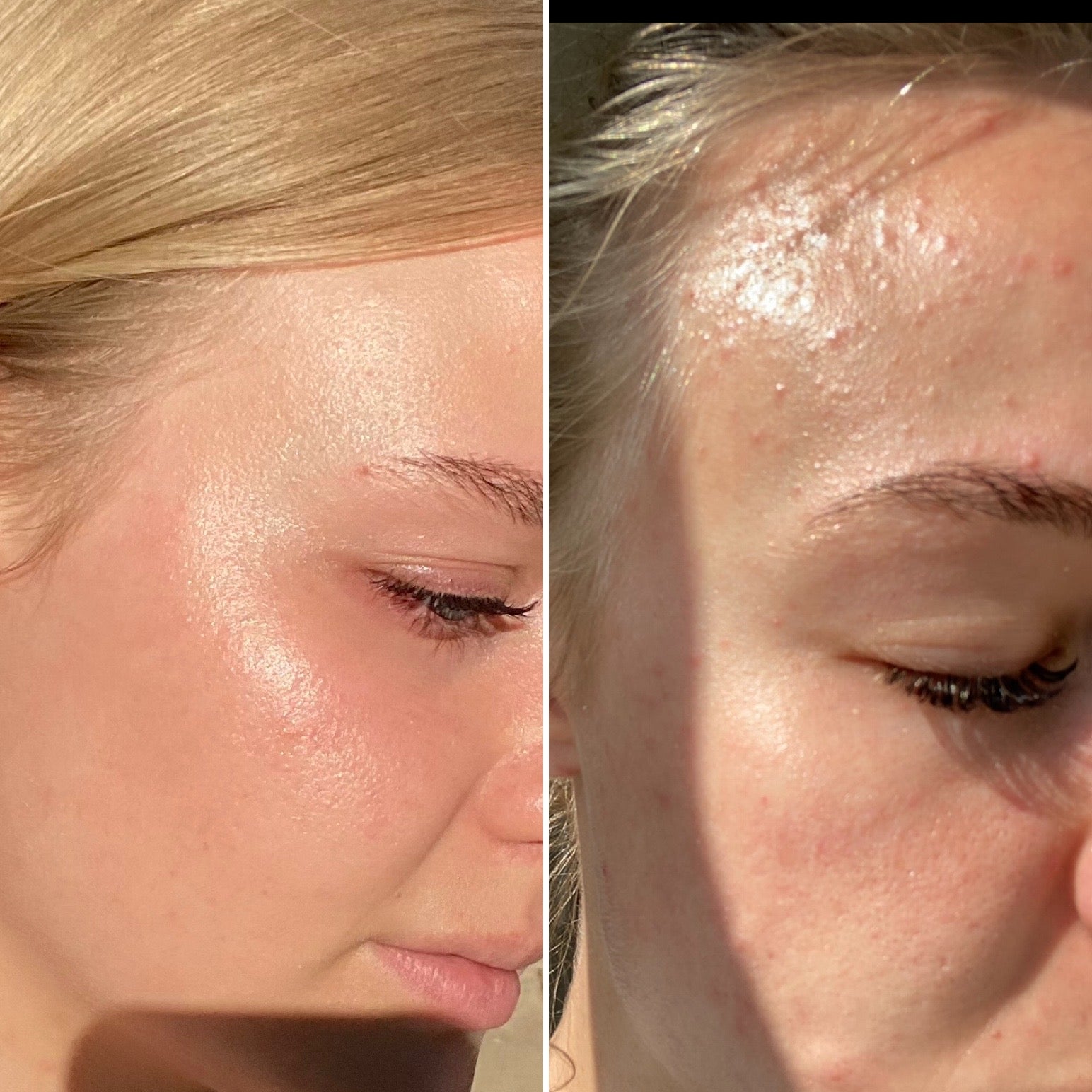 Mandelic Acid Serum 5% – Gentle Daily Exfoliating Serum for Sensitive & Blemish-Prone Skin - ElevateHealthTech